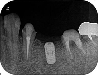 2012.12.19 1R5-thumb-400x306-10846.jpg