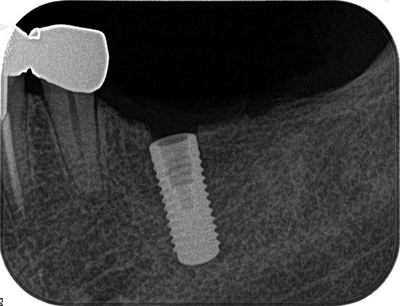 2013.10.04 02R076-thumb-400x306-19503.jpg