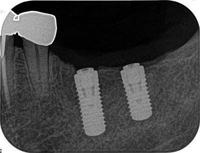 2013.10.04 03R076-thumb-400x307-19524.jpg