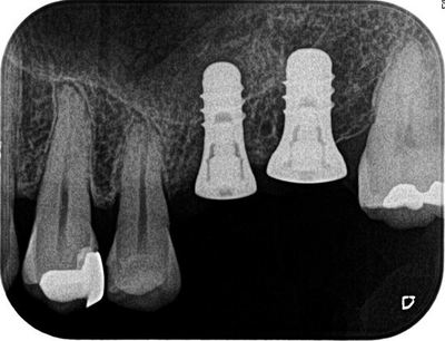 2013.10.19 1R3077-thumb-400x306-20244.jpg