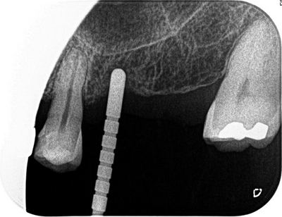 2013.10.19 2R077-thumb-400x308-20187.jpg