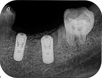 2014.01.06 2R078-thumb-400x306-22544.jpg