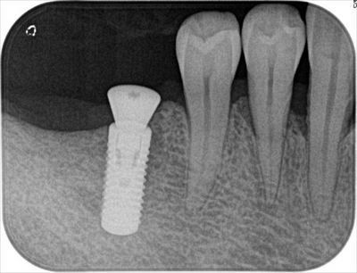 2015.10.10 02_R89-thumb-400x306-35926.jpg