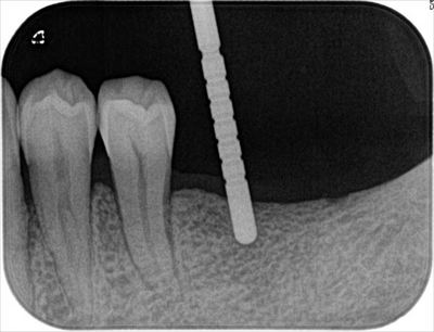 2015.10.10 03_R89-thumb-400x306-35917.jpg