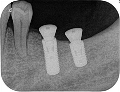 2015.10.10 04_R89-thumb-400x307-35920.jpg