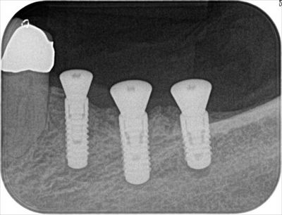 2015.11.02 021_R89-thumb-400x306-36348.jpg