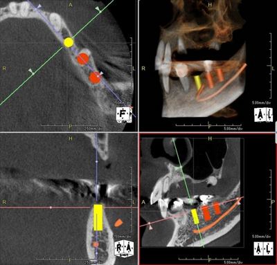 2015.11.02 CT_R89-thumb-400x383-36306.jpg