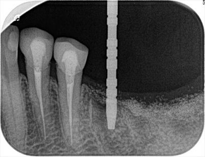 2016.06.10 01_R22-thumb-400x307-40173.jpg