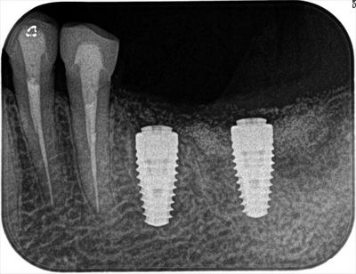 2016.06.10 02_R22-thumb-400x308-40206.jpg