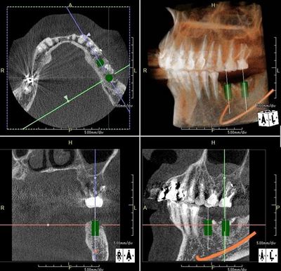 2016.06.10 CT_R22-thumb-400x386-40152.jpg