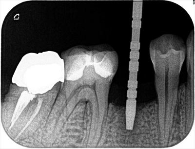 2016.06.25 01_R22-thumb-400x306-40383.jpg